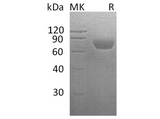 Recombinant Human CD48 Protein (His Tag) - ABMIUM