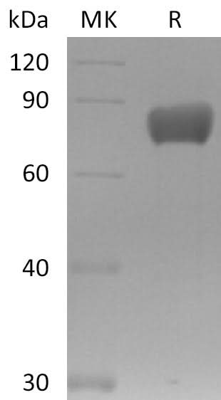 Recombinant Mouse FSTL1 Protein (Fc Tag) - ABMIUM