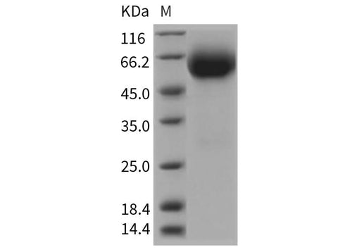 Recombinant Rat IL18R1 Protein (His Tag) - ABMIUM