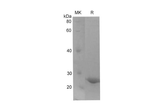 SDS-PAGE analysis of Human 4-1BBL/TNFSF9 proteins, 2 μg/lane of Recombinant Human 4-1BBL/TNFSF9 proteins was resolved with SDS-PAGE under reducing conditions, showing bands at 22-28 kDa.