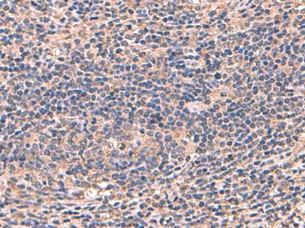 Anti-Human/Mouse/Rat AHCYL1 Antibody