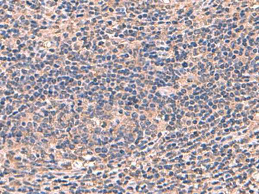 Anti-Human/Mouse/Rat AHCYL1 Antibody