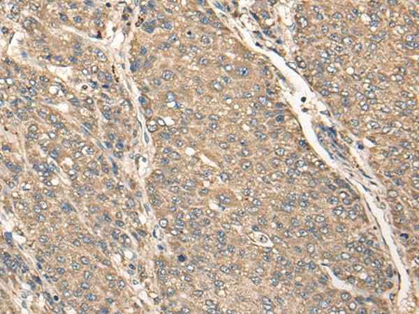 Anti-Human C17orf67 Antibody
