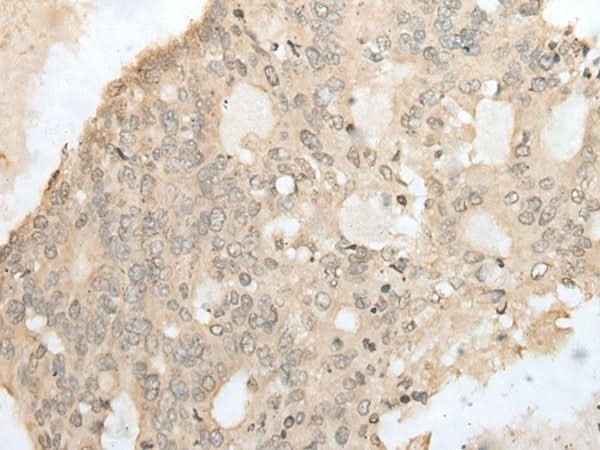 Anti-Human/Mouse ZZZ3 Antibody