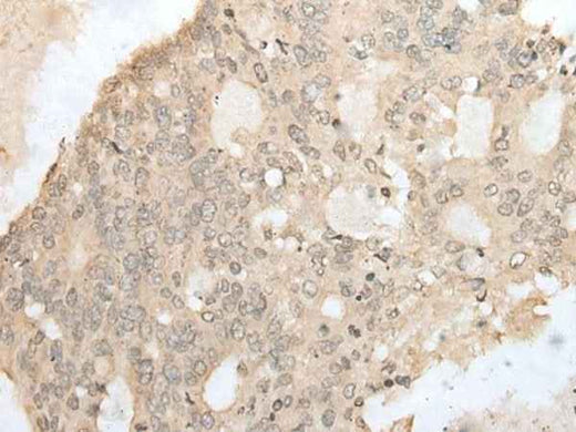 Anti-Human/Mouse ZZZ3 Antibody