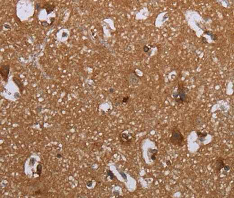 Anti-Human/Mouse/Rat LIMK1 Antibody