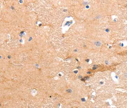 Anti-Human GPR64 Antibody