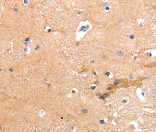 Anti-Human GPR64 Antibody - ABMIUM