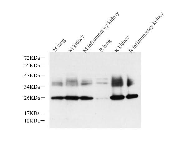 Western Blot analysis of various samples using AQP1 Polyclonal Antibody at dilution of 1:2000.