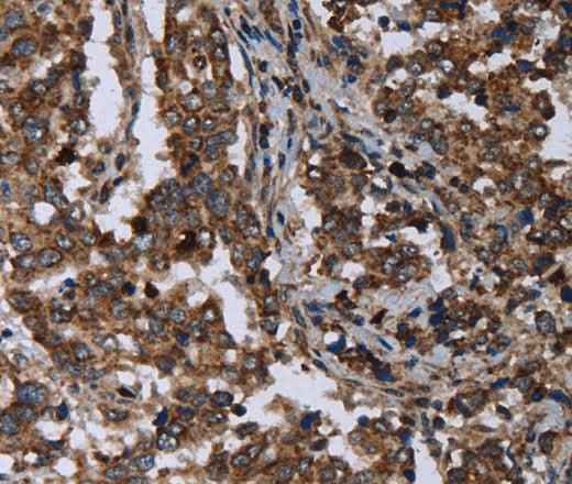 Anti-Human/Mouse DNAJC15 Antibody