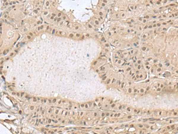 Anti-Human/Mouse/Rat PCLAF Antibody