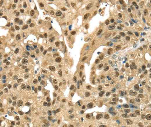 Anti-Human DFFA Antibody
