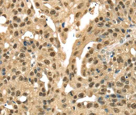 Anti-Human DFFA Antibody