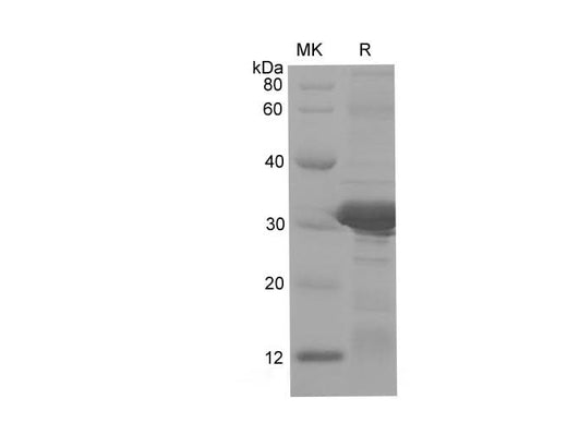 SDS-PAGE analysis of Human CD74 proteins, 2 μg/lane of Recombinant Human CD74 proteins was resolved with SDS-PAGE under reducing conditions, showing bands at 30-33 kDa.