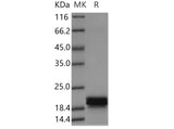 Recombinant Human CNPY2 Protein (His Tag) - ABMIUM