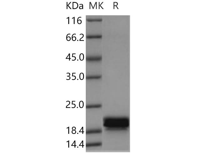 Recombinant Human CNPY2 Protein (His Tag) - ABMIUM