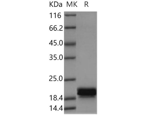 Recombinant Human CNPY2 Protein (His Tag) - ABMIUM