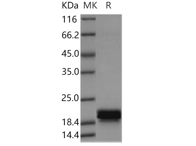Recombinant Human CNPY2 Protein (His Tag) - ABMIUM