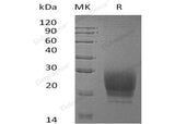 Recombinant Human PRND Protein (His Tag) - ABMIUM