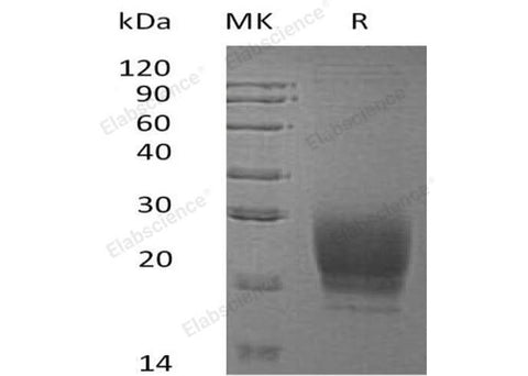 Recombinant Human PRND Protein (His Tag) - ABMIUM