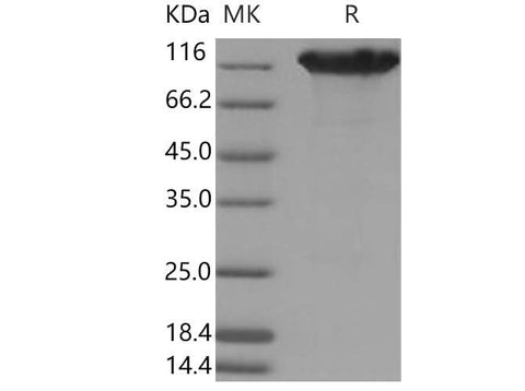 Recombinant Mouse ACE2 Protein (His & Fc Tag) - ABMIUM