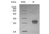 Recombinant Human GGCT Protein (His Tag) - ABMIUM