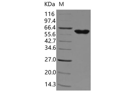 Recombinant Human tPA/PLAT Protein (aa 311-562, Fc Tag) - ABMIUM