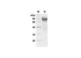 SDS-PAGE analysis of Mouse Fetuin A/AHSG proteins , 2 μg/lane of Recombinant Mammalian-derived Mouse Fetuin A/AHSG proteins Gln35-Ala425 was resolved with SDS-PAGE under reducing conditions , showing bands at 70-80 kDa.
