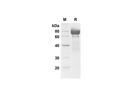 SDS-PAGE analysis of Mouse Fetuin A/AHSG proteins , 2 μg/lane of Recombinant Mammalian-derived Mouse Fetuin A/AHSG proteins Gln35-Ala425 was resolved with SDS-PAGE under reducing conditions , showing bands at 70-80 kDa.