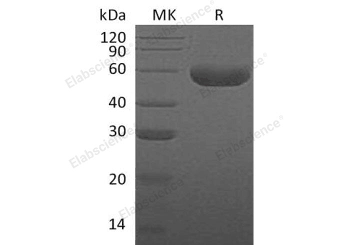 Recombinant Human Hyaluronidase-1/HYAL1 Protein (His Tag) - ABMIUM