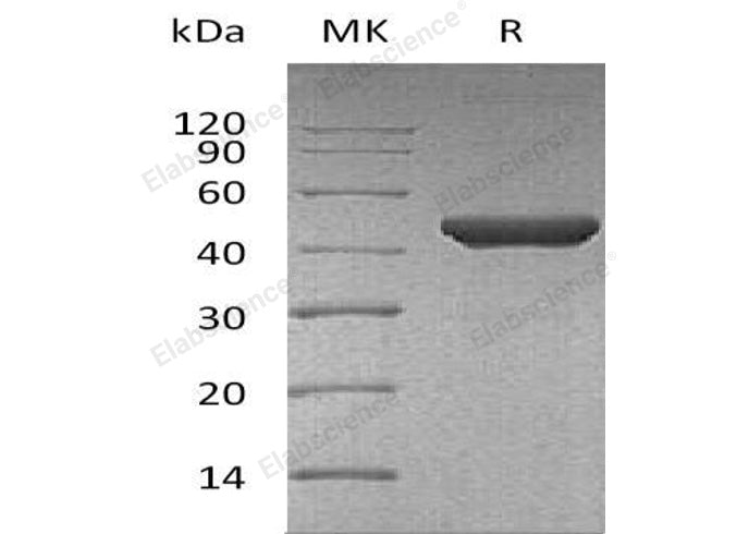 Recombinant Human Fumarase/FH Protein - ABMIUM
