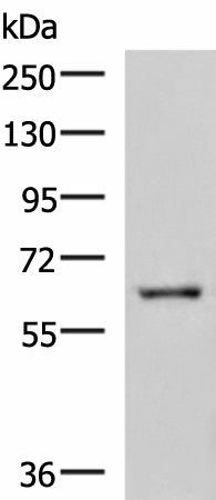 Western blot analysis of HepG2 cell lysate using LILRB5 Polyclonal Antibody at dilution of 1:600