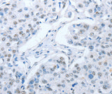 Anti-Human/Mouse/Rat ARHGEF2 Antibody - ABMIUM