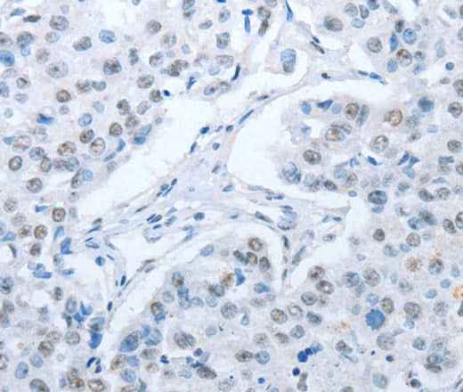Anti-Human/Mouse/Rat ARHGEF2 Antibody