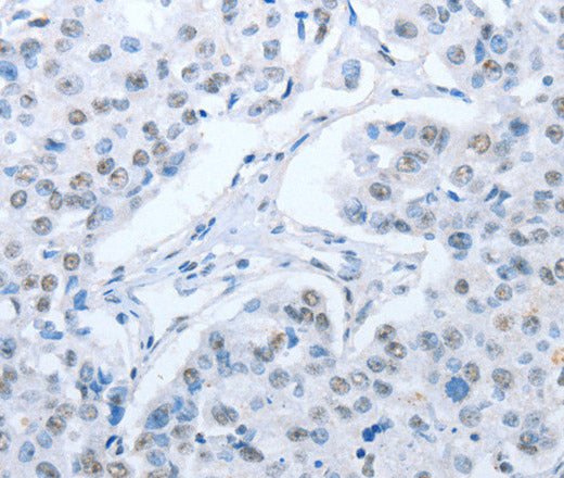 Anti-Human/Mouse/Rat ARHGEF2 Antibody - ABMIUM