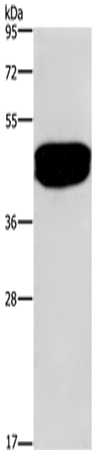Anti-Human/Mouse SDCCAG3 Antibody - ABMIUM