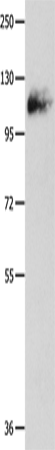 Anti-Human/Mouse Amphiphysin I Antibody - ABMIUM