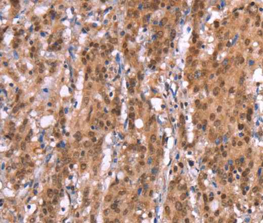 Anti-Human/Mouse AMER1 Antibody