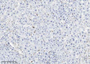 Anti-Human LYZ Antibody [A1050] - ABMIUM