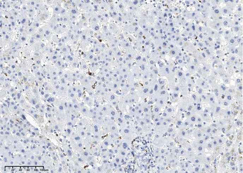 Anti-Human LYZ Antibody [A1050] - ABMIUM