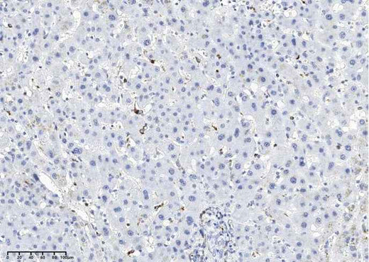 Anti-Human LYZ Antibody [A1050] - ABMIUM