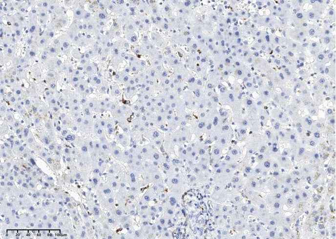 Anti-Human LYZ Antibody [A1050] - ABMIUM