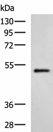 Western blot analysis of Hela cell lysate using HTRA2 Polyclonal Antibody at dilution of 1:500