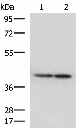 Western blot analysis of Human cerebella tissue and Human cerebrum tissue lysates using ATP6V1C1 Polyclonal Antibody at dilution of 1:500