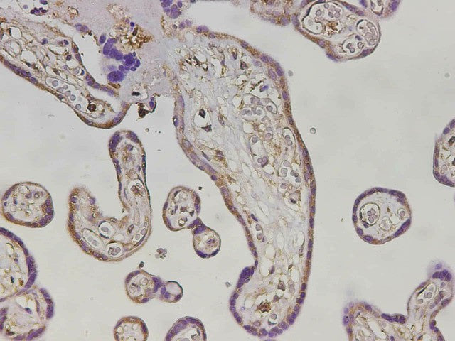 Immunohistochemistry of paraffin-embedded Human placenta tissue using MHCG Polyclonal Antibody at dilution of 1:3000(×400)