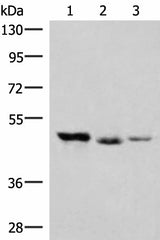 Western blot analysis of K562 and Jurkat cell Mouse kidney tissue lysates using HMBOX1 Polyclonal Antibody at dilution of 1:500