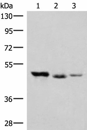 Western blot analysis of K562 and Jurkat cell Mouse kidney tissue lysates using HMBOX1 Polyclonal Antibody at dilution of 1:500