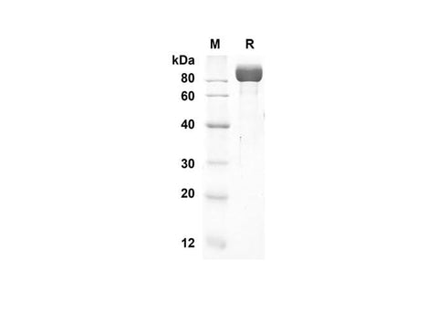 SDS-PAGE analysis of Human DPP4 proteins, 2 μg/lane of Recombinant Human DPP4 proteins was resolved with an SDS-PAGE under reducing conditions, showing bands at 81 kDa.