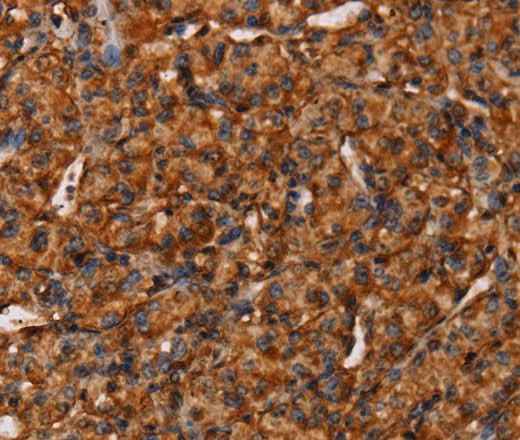 Anti-Human/Mouse COL18A1 Antibody