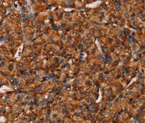 Anti-Human/Mouse COL18A1 Antibody